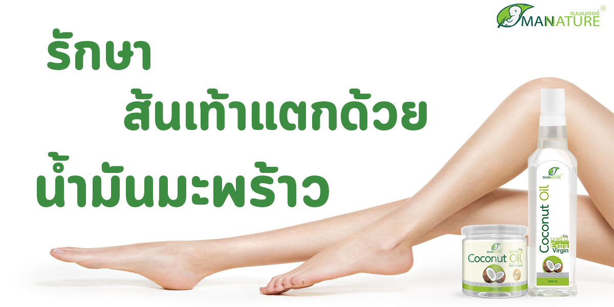 รักษา ส้นเท้าแตก ด้วย น้ำมันมะพร้าว ( Coconut Oil )